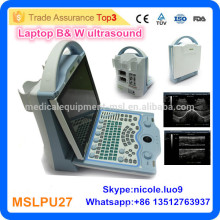 Медицинское оборудование портативная ультразвуковая машина цена / ультразвуковой сканер цена MSLPU27i